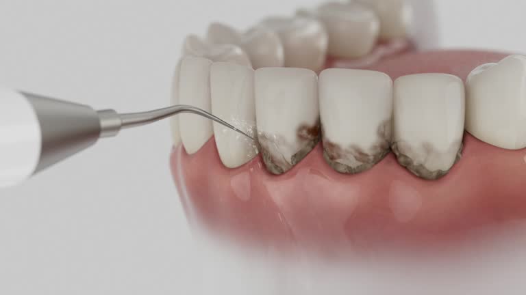 Reliable Dental Implants contractor in Greenbriar, VA by Smile Center Dentistry